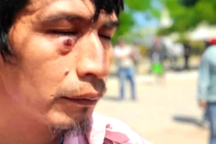 CHACO: MÁS DE 50 HERIDOS TRAS UNA VIOLENTA REPRESIÓN A COMUNIDADES ORIGINARIAS QUE RECLAMABAN ASISTENCIA ALIMENTARIA